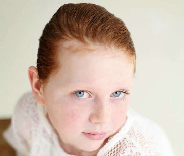 Fallon Emery is a 10-year-old Myrtle Beach girl battling brain cancer. Doctors originally predicted she had six months to live. Aggressive chemotherapy has raised that estimation to 36 months.